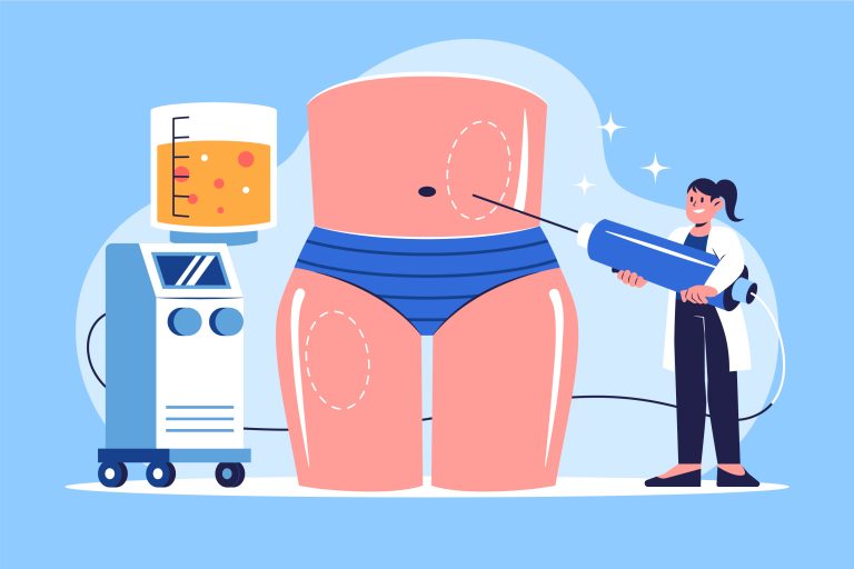 transfer lemak di liposuction jakarta