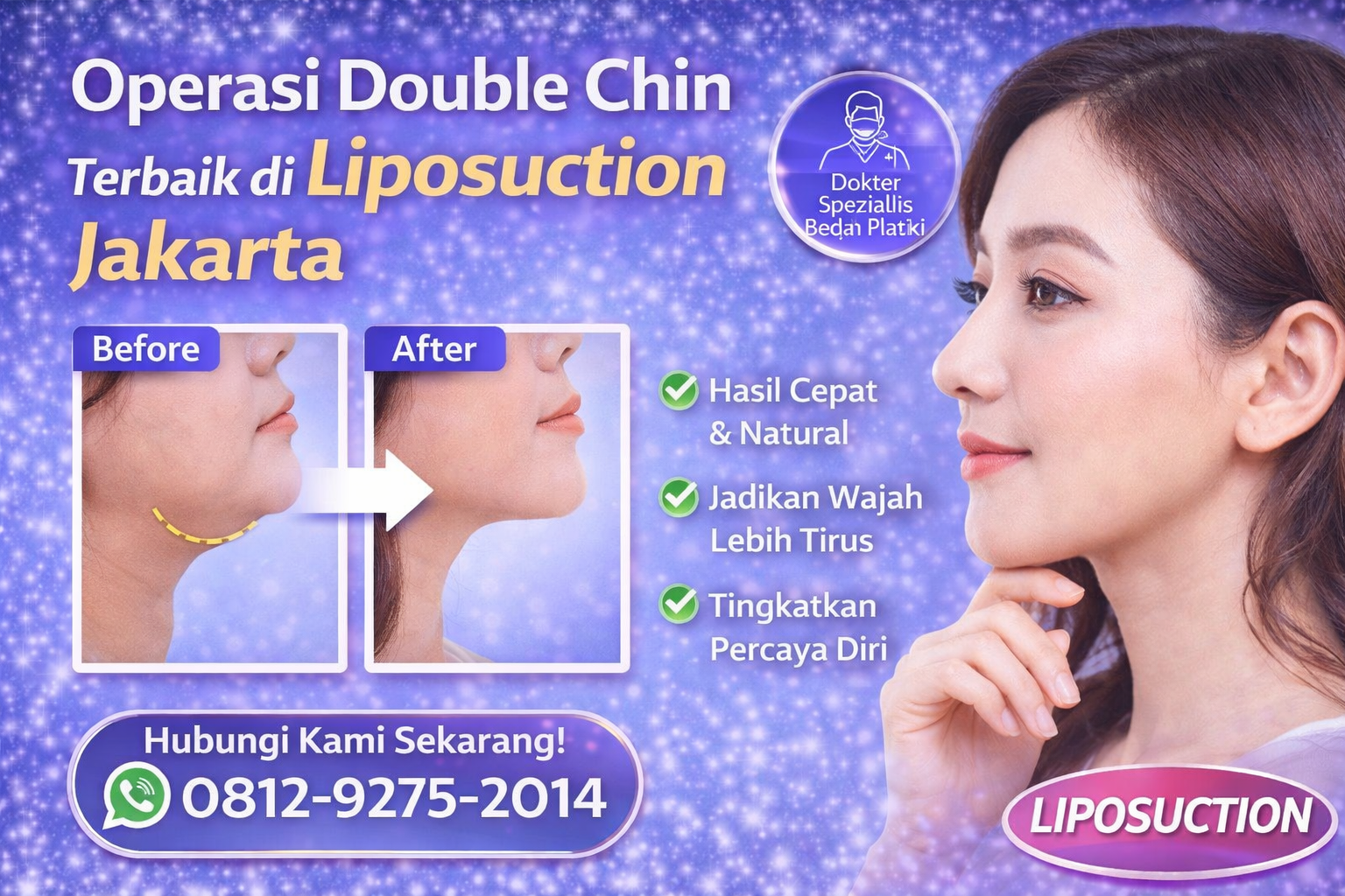 operasi double chin terbaik