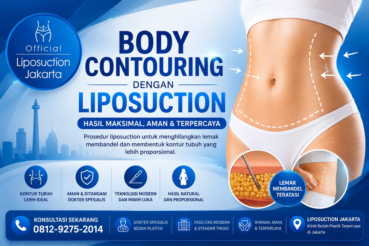 Dokter menjelaskan apakah sedot lemak bikin buncit lagi di Liposuction Jakarta.